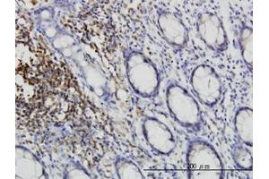 Image no. 2 for anti-C-Src tyrosine Kinase (CSK) (AA 1-101) antibody (ABIN598630) (CSK antibody  (AA 1-101))