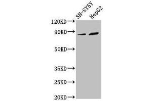 Western Blot Positive WB detected in: SH-SY5Y whole cell lysate, HepG2 whole cell lysate All lanes: DPY19L3 antibody at 3. (DPY19L3 antibody  (AA 587-697))
