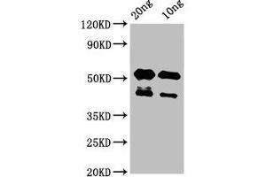 Western Blot Positive WB detected in Recombinant protein All lanes: lats2 antibody at 3 μg/mL Secondary Goat polyclonal to rabbit IgG at 1/50000 dilution Predicted band size: 43 kDa Observed band size: 43, 53 kDa