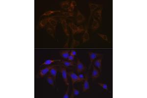 Immunofluorescence analysis of U-2 OS cells using V Rabbit mAb (ABIN7271312) at dilution of 1:100 (40x lens). (VAMP1 antibody)