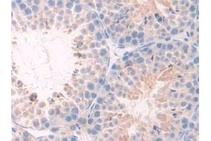 Detection of TNFR1 in Mouse Testis Tissue using Polyclonal Antibody to Tumor Necrosis Factor Receptor 1 (TNFR1) (TNFRSF1A antibody  (AA 239-433))