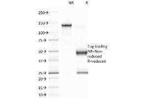 SDS-PAGE Analysis Purified EBV Mouse Monoclonal Antibody (CS1).
