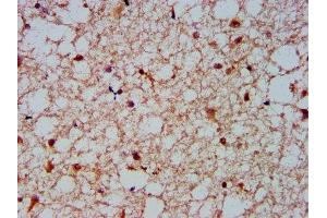 IHC image of ABIN7161538 diluted at 1:600 and staining in paraffin-embedded human brain tissue performed on a Leica BondTM system.