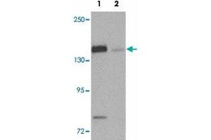 Western blot analysis of N4BP1 in HeLa cell lysate with N4BP1 polyclonal antibody  at 0. (N4BP1 antibody  (N-Term))