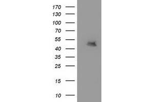 HEK293T cells were transfected with the pCMV6-ENTRY control (Left lane) or pCMV6-ENTRY MTFMT (Right lane) cDNA for 48 hrs and lysed. (MTFMT antibody)
