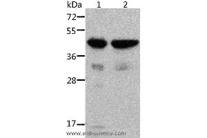 Western blot analysis of Mouse muscle and heart tissue, using ACTA1 Polyclonal Antibody at dilution of 1:500 (Actin antibody)