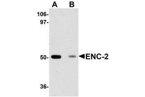 Western blot analysis of ENC-2 in Jurkat cell lysate with AP30315PU-N ENC-2 antibody at 1 μg/ml in (A) the absence and (B) the presence of blocking peptide. (KLHL25 antibody  (Center))