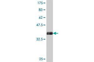 Western Blot detection against Immunogen (37. (ESM1 antibody  (AA 85-184))