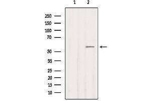 Western blot analysis of extracts from COS-7, using Cytochrome P450 2B6 Antibody.
