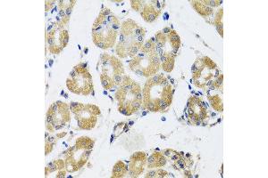 Immunohistochemistry of paraffin-embedded human gastric using RAD51C antibody at dilution of 1:100 (x40 lens).