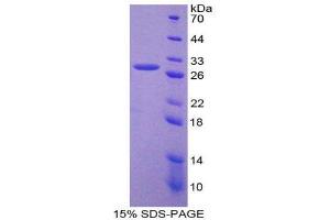 SDS-PAGE (SDS) image for Glypican 3 (GPC3) (AA 344-559) protein (His tag) (ABIN2125057)