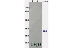 L1 rat brain lysates L2 rat lung lysates probed with Anti PHAP1 Polyclonal Antibody, Unconjugated (ABIN762176) at 1:200 in 4 °C. (PHAP antibody  (AA 41-140))