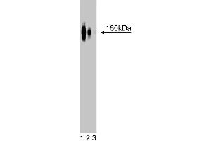 Western blot analysis of delta-Catenin on a rat cerebrum lysate. (CTNND2 antibody  (AA 85-194))