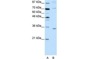 Western Blotting (WB) image for anti-Atonal Homolog 8 (ATOH8) antibody (ABIN2461959) (ATOH8 antibody)