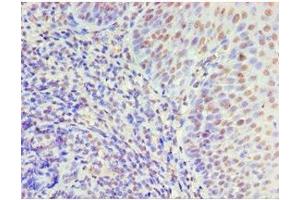 Immunohistochemistry of paraffin-embedded human tonsil tissue using ABIN7150338 at dilution of 1:100 (MCM5 antibody  (AA 1-230))