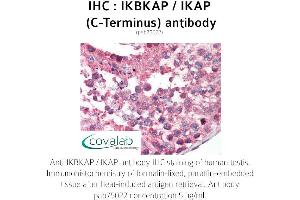 Image no. 1 for anti-Elongator Complex Protein 1 (ELP1) antibody (ABIN1735852) (IKAP/p150 antibody)