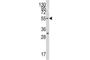 Western blot analysis of TRF1 antibody and Jurkat lysate (TRF1 antibody  (AA 337-366))