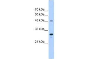 Western Blotting (WB) image for anti-Cytochrome P450, Family 2, Subfamily C, Polypeptide 9 (CYP2C9) antibody (ABIN2462479) (CYP2C9 antibody)