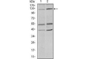 Western blot analysis using PIWIL4 mouse mAb against PC-3 (1) and PANC-1 (2) cell lysate. (PIWIL4 antibody  (AA 304-434))