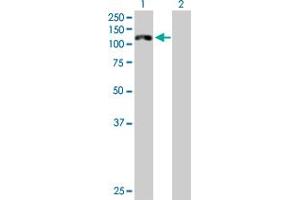 Western Blot analysis of CDH16 expression in transfected 293T cell line by CDH16 MaxPab polyclonal antibody. (Cadherin-16 antibody  (AA 1-829))