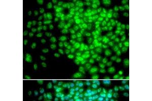 Immunofluorescence analysis of HeLa cells using POLR2F Polyclonal Antibody (POLR2F antibody)