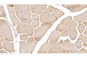 Detection of MYH2 in Human Skeletal muscle Tissue using Polyclonal Antibody to Myosin Heavy Chain 2 (MYH2) (MYH2 antibody  (AA 1237-1471))