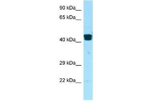 WB Suggested Anti-LIMS1 Antibody Titration: 1. (LIMS1 antibody  (Middle Region))