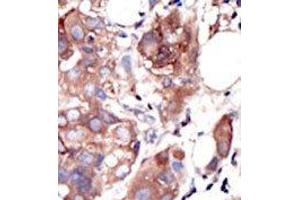 Image no. 2 for anti-Muscle, Skeletal, Receptor Tyrosine Kinase (MUSK) (C-Term) antibody (ABIN359903) (MUSK antibody  (C-Term))