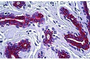 Human Breast: Formalin-Fixed, Paraffin-Embedded (FFPE) (Keratin 8/18/19 antibody)