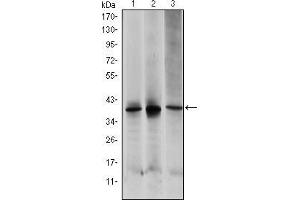 Western blot analysis using MAP2K6 mouse mAb against HepG2 (1), MCF-7 (2) and NIH/3T3 (3) cell lysate. (MAP2K6 antibody)