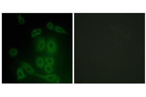 Immunofluorescence analysis of A549 cells, using FXR2 antibody. (FXR2 antibody  (C-Term))