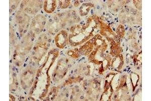 Immunohistochemistry of paraffin-embedded human kidney tissue using ABIN7147659 at dilution of 1:100 (GCM2 antibody  (AA 156-451))