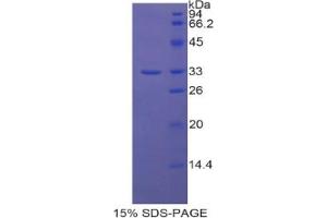 SDS-PAGE analysis of Human AST Protein.