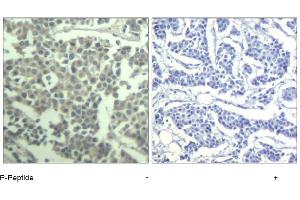 Image no. 1 for anti-Mast/stem Cell Growth Factor Receptor (KIT) (pTyr936) antibody (ABIN319287) (KIT antibody  (pTyr936))