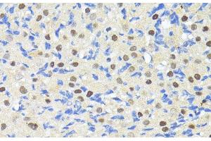 Immunohistochemistry of paraffin-embedded Rat ovary using TRIM27 Polyclonal Antibody at dilution of 1:100 (40x lens). (TRIM27 antibody)