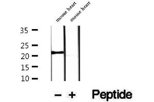 Western blot analysis of extracts of mouse heart tissue, using COQ7 antibody. (Coq7 antibody  (Internal Region))