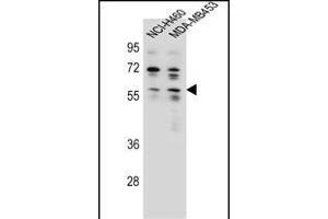 ANKRD34C Antibody (C-term) (ABIN655772 and ABIN2845210) western blot analysis in NCI-,MDA-M cell line lysates (35 μg/lane). (ANKRD34C antibody  (C-Term))