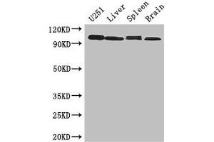 Western Blot Positive WB detected in: U251 whole cell lysate, Mouse liver tissue, Mouse Spleen tissue, Mouse brain tissue All lanes: MAP10 antibody at 3 μg/mL Secondary Goat polyclonal to rabbit IgG at 1/50000 dilution Predicted band size: 101 kDa Observed band size: 101 kDa (MAP1 antibody  (AA 401-600))