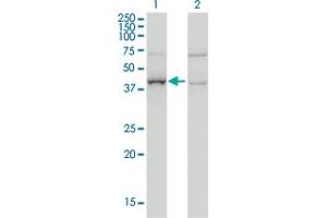 Western Blot analysis of ARMC8 expression in transfected 293T cell line by ARMC8 monoclonal antibody (M01), clone 2D9.