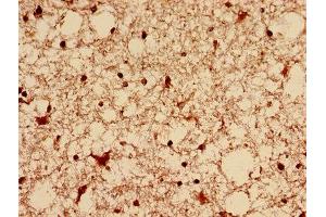 Immunohistochemistry analysis of human brain tissue using ABIN7150829 at dilution of 1:100 (Dynamin 1-Like antibody  (AA 496-710))