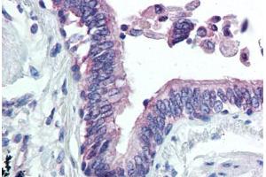 Lung, respiratory epithelium (CLIC4 antibody  (N-Term))