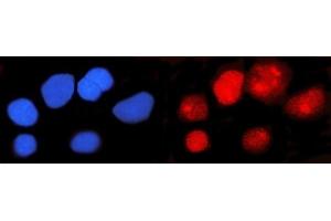 IF analysis of IFI16 using anti-IFI16 antibody (ABIN7600373). (IFI16 antibody  (AA 183-743))