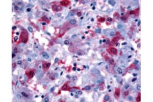 Anti-PTGFR antibody IHC of human adrenal, pheochromocytes. (PTGFR antibody  (Cytoplasmic Domain))