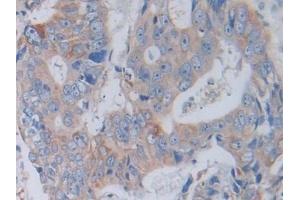 Immunohistochemistry (IHC) image for anti-Cathepsin L2 (CTSL2) (AA 64-334) antibody (ABIN7435274)