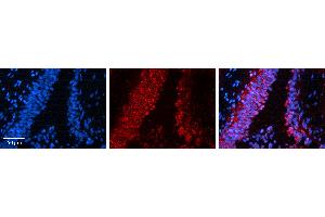 Immunohistochemistry (IHC) image for anti-SNAIL (SNAI1) (N-Term) antibody (ABIN2777858)