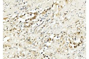 IHC analysis of PDCD4 using anti-PDCD4 antibody (ABIN5518943).