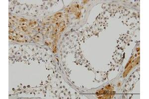 Image no. 1 for anti-CAMP Responsive Element Binding Protein 3 (CREB3) (AA 273-372) antibody (ABIN599141) (CREB3 antibody  (AA 273-372))
