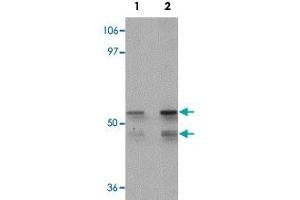Western blot analysis of human liver tissue with KLF4 polyclonal antibody  at (Lane 1) 1 and (Lane 2) 2 ug/mL dilution. (KLF4 antibody  (C-Term))