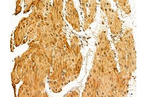 ABIN7094334 and ABIN7098381 at 1/100 staining Rat stomach tissue by IHC-P. (LARS2 antibody  (Internal Region))