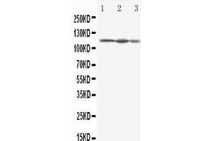 Anti-Eif3b antibody, Western blotting Lane 1: HELA Cell Lysate Lane 2: 293T Cell Lysate Lane 3: A431 Cell Lysate
